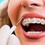 Orthodontics Restoration