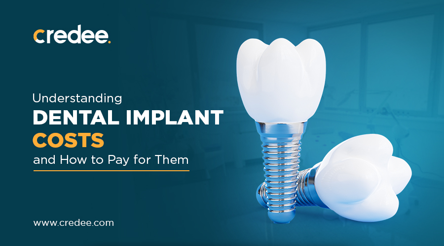 How Much Do Dental Implants Cost Without Insurance? ( 2024 )