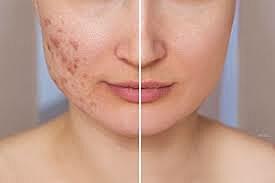 Fade Away Laser and Skin Centre