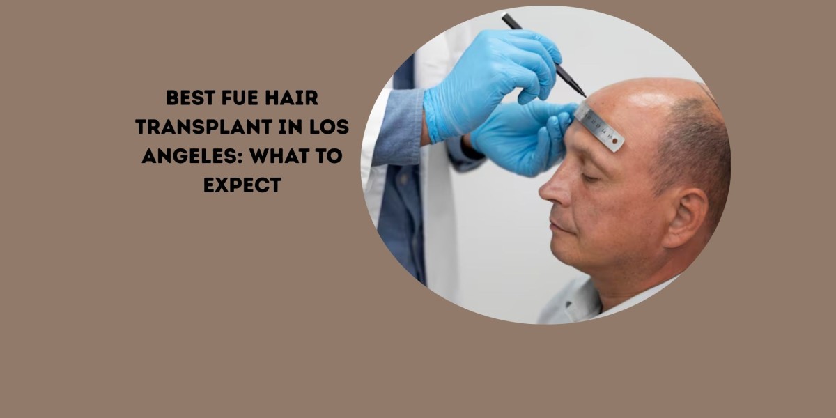 Best FUE Hair Transplant in Los Angeles: What to Expect