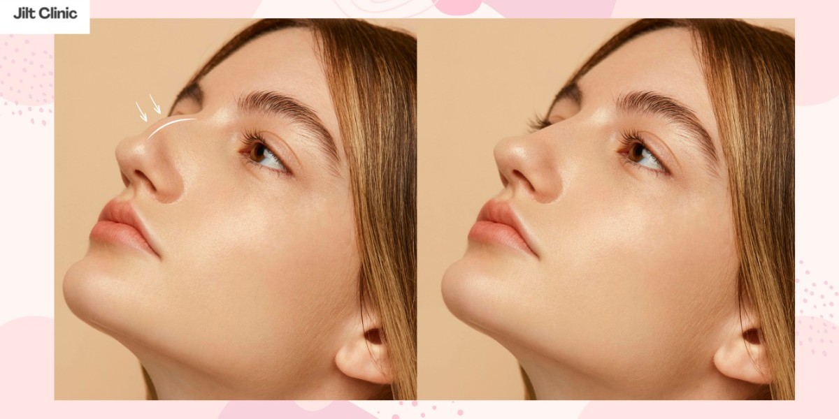 Jawline Deutsch: Für eine klare und ästhetische Kieferlinie