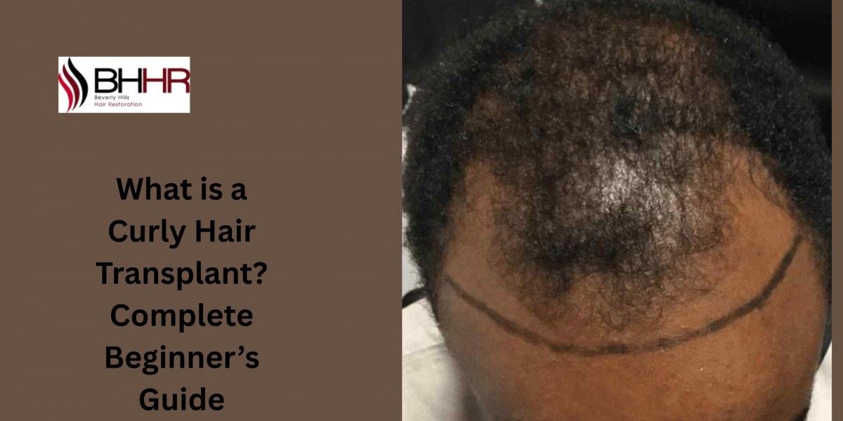 What is a Curly Hair Transplant? Complete Beginner’s Guide