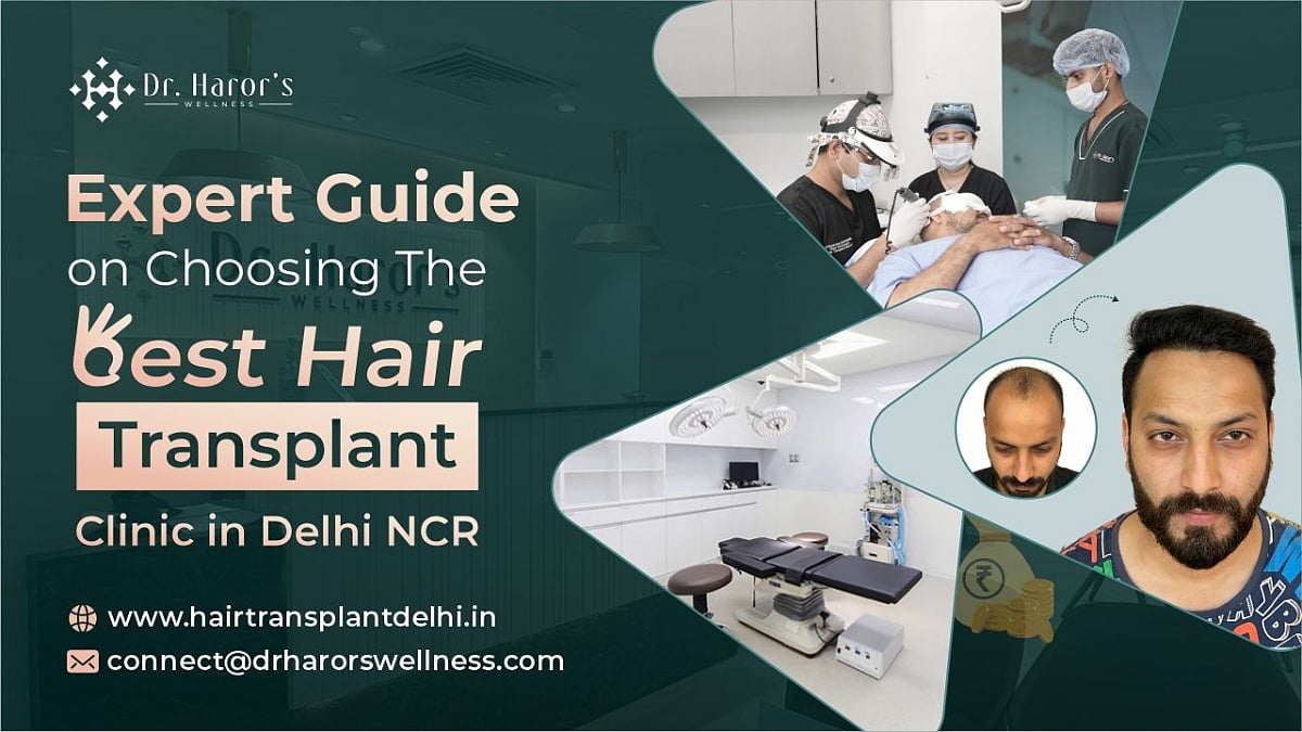 Expert Guide On Choosing The Best Hair Transplant Clinic In Delhi NCR – Outlook Business