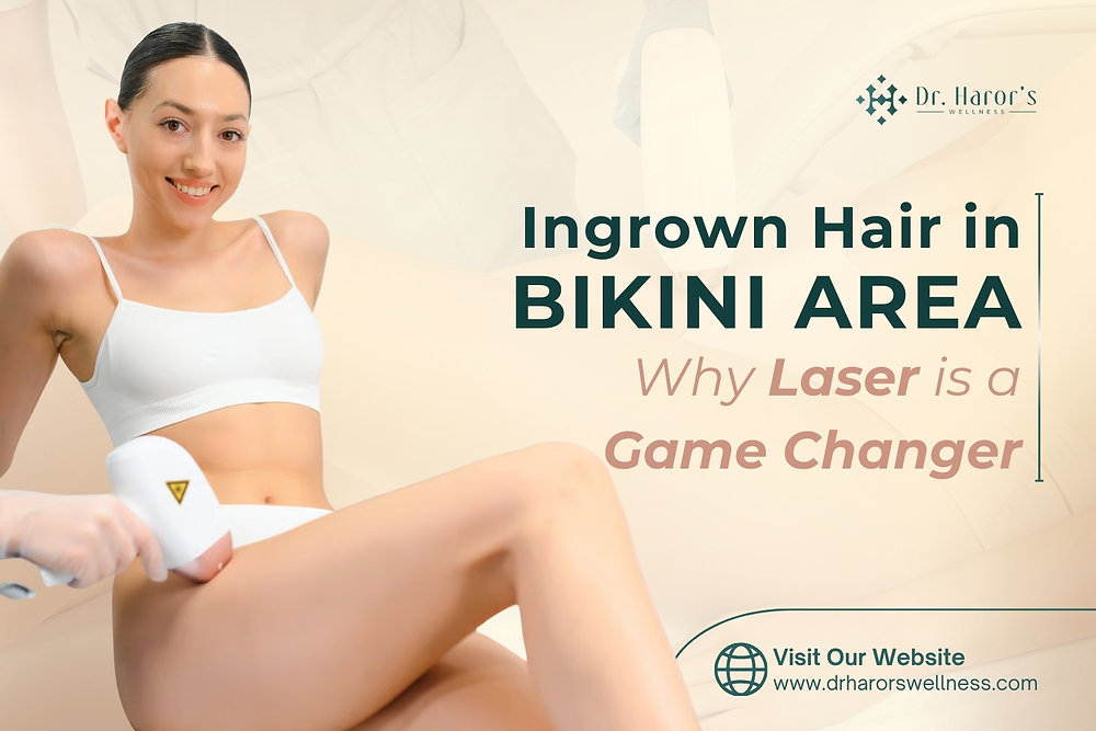 Ingrown Hair in Bikini Area: Why Laser is a Game C****er